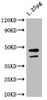 Western Blot<br />
Positive WB detected in: Escherichia coli lysate<br />
All lanes: ompF antibody at 1:4000<br />
Secondary<br />
Goat polyclonal to rabbit IgG at 1/50000 dilution<br />
Predicted band size: 44 kDa<br />
Observed band size: 44 kDa<br />