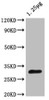 Western Blot<br />
Positive WB detected in: Escherichia coli lysate<br />
All lanes: OTSB antibody at 1:2000<br />
Secondary<br />
Goat polyclonal to rabbit IgG at 1/50000 dilution<br />
Predicted band size: 30 kDa<br />
Observed band size: 30 kDa<br />
