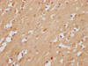 IHC image of PACO64973 diluted at 1:200 and staining in paraffin-embedded human brain tissue performed on a Leica BondTM system. After dewaxing and hydration, antigen retrieval was mediated by high pressure in a citrate buffer (pH 6.0). Section was blocked with 10% normal goat serum 30min at RT. Then primary antibody (1% BSA) was incubated at 4&deg;C overnight. The primary is detected by a Goat anti-rabbit polymer IgG labeled by HRP and visualized using 0.05% DAB.