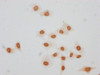 Immunocytochemistry analysis of PACO65094 diluted at 1:20 and staining in Hela cells(treated with 30mM sodium butyrate for 4h) performed on a Leica BondTM system. The cells were fixed in 4% formaldehyde, permeabilized using 0.2% Triton X-100 and blocked with 10% normal goat serum 30min at RT. Then primary antibody (1% BSA) was incubated at 4&deg;C overnight. The primary is detected by a biotinylated secondary antibody and visualized using an HRP conjugated SP system.