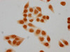 Immunocytochemistry analysis of PACO65126 diluted at 1:15 and staining in Hela cells(treated with 30mM sodium butyrate for 4h) performed on a Leica BondTM system. The cells were fixed in 4% formaldehyde, permeabilized using 0.2% Triton X-100 and blocked with 10% normal goat serum 30min at RT. Then primary antibody (1% BSA) was incubated at 4&deg;C overnight. The primary is detected by a biotinylated secondary antibody and visualized using an HRP conjugated SP system.
