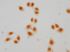 Immunocytochemistry analysis of PACO65141 diluted at 1:50 and staining in Hela cells(treated with 30mM sodium crotonylate for 4h) performed on a Leica BondTM system. The cells were fixed in 4% formaldehyde, permeabilized using 0.2% Triton X-100 and blocked with 10% normal goat serum 30min at RT. Then primary antibody (1% BSA) was incubated at 4&deg;C overnight. The primary is detected by a biotinylated secondary antibody and visualized using an HRP conjugated SP system.