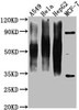 Western Blot<br />
Positive WB detected in: A549 whole cell lysate, Hela whole cell lysate, HepG2 whole cell lysate, MCF-7 whole cell lysate <br />
All lanes CD63 antibody at 1:1000<br />
Secondary<br />
Goat polyclonal to mouse IgG at 1/50000 dilution<br />
Predicted band size: 30-120 KD KDa<br />
Observed band size: 30-120 KD KDa<br />
Exposure time：1min