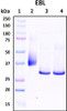 Figure 1. Deglycosylation analysis of purified recombinant proteins. The same amount of purified proteins were untreated (Lane 2) or treated with protein deglycosylation enzymes under native (Lane 3) or reducing (Lane 4) conditions. Deglycosylation treatment resulted in a mobility shift of the protein to produce one reduced band at the expected size, thus indicating that the untreated recombinant protein (Lane 2) was glycosylated. Lane 1: protein standard ladder (kDa). Lane 2: untreated protein. Lane 3: treated protein with deglycosylation enzymes under native conditions. Lane 4: treated protein with deglycosylation enzymes under denature conditions.