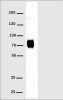 Anti-His Tag Recombinant Rabbit Monoclonal Antibody (HDAB0187)