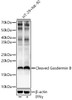 Western blot analysis of lysates from HT-29+NK-92, using Cleaved Gasdermin B Rabbit pAb (CAB23046) at 1:400 dilution. HT-29 and NK-92 cells were treated by IFNγ (50ng/ml) for 8 hours. Secondary antibody: HRP Goat Anti-Rabbit IgG (H+L) at 1:10000 dilution. Lysates/proteins: 25ug per lane. Blocking buffer: 3% nonfat dry milk in TBST.