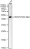 Western blot analysis of HLE, using VISTA / B7-H5 / GI24 Rabbit pAb (CAB24535) at 1:1000 dilution. Secondary antibody: HRP Goat Anti-Rabbit IgG (H+L) at 1:10000 dilution. Lysates/proteins: 25ug per lane. Blocking buffer: 3% nonfat dry milk in TBST.