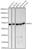 Western blot analysis of various lysates, using RPN1 Rabbit pAb (CAB24537) at 1:1000 dilution. Secondary antibody: HRP Goat Anti-Rabbit IgG (H+L) at 1:10000 dilution. Lysates/proteins: 25ug per lane. Blocking buffer: 3% nonfat dry milk in TBST.