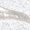 Immunohistochemistry analysis of paraffin-embedded human cervical using FOXQ1 Rabbit pAb (CAB24546) at dilution of 1:50 (40x lens). Perform high pressure antigen retrieval with 10 mM citrate buffer pH 6. 0 before commencing with IHC staining protocol.