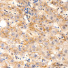 Immunohistochemistry analysis of NINJ1 in paraffin-embedded human liver tissue using NINJ1 Rabbit mAb (CAB24739) at a dilution of 1:200 (40x lens). High pressure antigen retrieval was performed with 0. 01 M citrate buffer (pH 6. 0) prior to IHC staining.