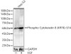 Western blot analysis of lysates from Hep G2, using Phospho-Cytokeratin 8 (KRT8)-S74 Rabbit pAb (CABP1299) at 1:1000 dilution. Hep G2 cells were treated by EGF (100 ng/ml) at 37℃ for 30 minutes after serum-starvation overnight. Secondary antibody: HRP Goat Anti-Rabbit IgG (H+L) at 1:10000 dilution. Lysates/proteins: 25ug per lane. Blocking buffer: 3% nonfat dry milk in TBST.