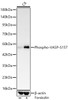 Western blot analysis of lysates from C6 cells, using Phospho-VASP-S157 Rabbit mAb (CABP1510) at 1:4000 dilution. C6 cells were treated by Forskolin (30 uM) at 37℃ for 30 minutes after serum-starvation overnight. Secondary antibody: HRP Goat Anti-Rabbit IgG (H+L) at 1:10000 dilution. Lysates/proteins: 25ug per lane. Blocking buffer: 3% nonfat dry milk in TBST.