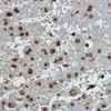 Immunohistochemistry analysis of paraffin-embedded human liver using Formyl-Histone H2B-K108 Rabbit mAb (CAB0032) at dilution of 1:100 (40x lens). Perform high pressure antigen retrieval with 10 mM citrate buffer pH 6. 0 before commencing with IHC staining protocol.
