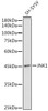 Western blot analysis of extracts of SH-SY5Y cells, using JNK1 antibody (CAB0288) at 1:1000 dilution. Secondary antibody: HRP Goat Anti-Rabbit IgG (H+L) at 1:10000 dilution. Lysates/proteins: 25μg per lane. Blocking buffer: 3% nonfat dry milk in TBST.
