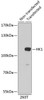 Western blot analysis of extracts of 293T cells, using HK1 antibody (CAB0546). Secondary antibody: HRP Goat Anti-Rabbit IgG (H+L) at 1:10000 dilution. Lysates/proteins: 25μg per lane. Blocking buffer: 3% nonfat dry milk in TBST.