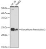 Western blot analysis of various lysates, using Glutathione Peroxidase 2 antibody (CAB11171) at 1:1000 dilution. Secondary antibody: HRP Goat Anti-Rabbit IgG (H+L) at 1:10000 dilution. Lysates/proteins: 25μg per lane. Blocking buffer: 3% nonfat dry milk in TBST.