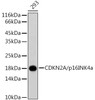 Western blot analysis of extracts of 293 cells, using CDKN2A/p16INK4a antibody (CAB11920). Secondary antibody: HRP Goat Anti-Rabbit IgG (H+L) at 1:10000 dilution. Lysates/proteins: 25μg per lane. Blocking buffer: 3% nonfat dry milk in TBST.