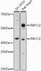 Western blot analysis of extracts of various cell lines, using JNK1/2 antibody (CAB18287) at 1:500 dilution. Secondary antibody: HRP Goat Anti-Rabbit IgG (H+L) at 1:10000 dilution. Lysates/proteins: 25μg per lane. Blocking buffer: 3% nonfat dry milk in TBST.