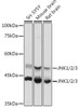 Western blot analysis of extracts of various cell lines, using JNK1/2/3 antibody (CAB18678) at 1:1000 dilution. Secondary antibody: HRP Goat Anti-Rabbit IgG (H+L) at 1:10000 dilution. Lysates/proteins: 25μg per lane. Blocking buffer: 3% nonfat dry milk in TBST.