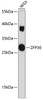 Western blot analysis of extracts of WiDr cells, using ZFP36 antibody (CAB1878). Secondary antibody: HRP Goat Anti-Rabbit IgG (H+L) at 1:10000 dilution. Lysates/proteins: 25μg per lane. Blocking buffer: 3% nonfat dry milk in TBST.
