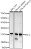 Western blot analysis of various lysates, using Bcl-2 antibody (CAB20736) at 1:1000 dilution. Secondary antibody: HRP Goat Anti-Rabbit IgG (H+L) at 1:10000 dilution. Lysates/proteins: 25μg per lane. Blocking buffer: 3% nonfat dry milk in TBST.