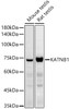 Western blot analysis of extracts of various cell lines, using KATNB1 antibody (CAB21041) at 1:1000 dilution. Secondary antibody: HRP Goat Anti-Rabbit IgG (H+L) at 1:10000 dilution. Lysates/proteins: 25μg per lane. Blocking buffer: 3% nonfat dry milk in TBST.