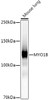 Western blot analysis of extracts of Mouse lung, using MYO1B antibody (CAB21113) at1:1000 dilution. Secondary antibody: HRP Goat Anti-Rabbit IgG (H+L) at 1:10000 dilution. Lysates/proteins: 25μg per lane. Blocking buffer: 3% nonfat dry milk in TBST.