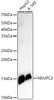 Western blot analysis of various lysates, using NDUFC2 Rabbit mAb (CAB21116) at1:500 dilution. Secondary antibody: HRP Goat Anti-Rabbit IgG (H+L) at 1:10000 dilution. Lysates/proteins: 25μg per lane. Blocking buffer: 3% nonfat dry milk in TBST.