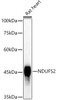 Western blot analysis of extracts of Rat heart, using NDUFS2 antibody (CAB21117) at1:1000 dilution. Secondary antibody: HRP Goat Anti-Rabbit IgG (H+L) at 1:10000 dilution. Lysates/proteins: 25μg per lane. Blocking buffer: 3% nonfat dry milk in TBST.