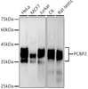 Western blot analysis of extracts of various cell lines, using hnRNP E2/PCBP2 antibody (CAB21119) at1:1000 dilution. Secondary antibody: HRP Goat Anti-Rabbit IgG (H+L) at 1:10000 dilution. Lysates/proteins: 25μg per lane. Blocking buffer: 3% nonfat dry milk in TBST.