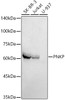 Western blot analysis of extracts of various cell lines, using PNKP antibody (CAB21145) at1:1000 dilution. Secondary antibody: HRP Goat Anti-Rabbit IgG (H+L) at 1:10000 dilution. Lysates/proteins: 25μg per lane. Blocking buffer: 3% nonfat dry milk in TBST.