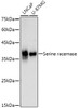 Western blot analysis of extracts of various cell lines, using Serine racemase antibody (CAB21158) at1:1000 dilution. Secondary antibody: HRP Goat Anti-Rabbit IgG (H+L) at 1:10000 dilution. Lysates/proteins: 25μg per lane. Blocking buffer: 3% nonfat dry milk in TBST.