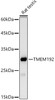 Western blot analysis of extracts from rat testis, using TMEM192 antibody (CAB21165) at 1:1000 dilution. Secondary antibody: HRP Goat Anti-Rabbit IgG (H+L) at 1:10000 dilution. Lysates/proteins: 25ug per lane. Blocking buffer: 3% nonfat dry milk in TBST.