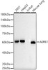 Western blot analysis of extracts of various cell lines, using AER61 antibody (CAB21166) at1:1000 dilution. Secondary antibody: HRP Goat Anti-Rabbit IgG (H+L) at 1:10000 dilution. Lysates/proteins: 25μg per lane. Blocking buffer: 3% nonfat dry milk in TBST.