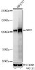 Western blot analysis of extracts of NIH/3T3 cells, using NRF2 antibody (CAB21176) at1:1000 dilution. NIH/3T3 cells were treated by MG132(50 μM) at 37℃ for 90 minutes. Secondary antibody: HRP Goat Anti-Rabbit IgG (H+L) at1:10000 dilution. Lysates/proteins: 25μg per lane. Blocking buffer: 3% nonfat dry milk in TBST.