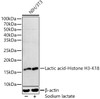 Western blot analysis of extracts of NIH/3T3 cells, using Lactic acid-Histone H3-K18 antibody (CAB21214) at1:2000 dilution. NIH/3T3 cells were treated by Sodium lactate(100mM) for 24h. Secondary antibody: HRP Goat Anti-Rabbit IgG (H+L) at 1:10000 dilution. Lysates/proteins: 25μg per lane. Blocking buffer: 3% nonfat dry milk in TBST.