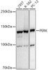 Western blot analysis of extracts of various cell lines, using PERK antibody (CAB21255) at1:1000 dilution. Secondary antibody: HRP Goat Anti-Rabbit IgG (H+L) at 1:10000 dilution. Lysates/proteins: 25μg per lane. Blocking buffer: 3% nonfat dry milk in TBST.
