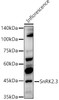 Western blot analysis of extracts of Inflorescence, using SnRK2. 3 antibody (CAB21281) at 1:1000 dilution. Secondary antibody: HRP Goat Anti-Rabbit IgG (H+L) at 1:10000 dilution. Lysates/proteins: 25μg per lane. Blocking buffer: 3% nonfat dry milk in TBST.