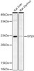 Western blot analysis of extracts of various cell lines, using RPS9 antibody (CAB21298) at 1:500 dilution. Secondary antibody: HRP Goat Anti-Rabbit IgG (H+L) at 1:10000 dilution. Lysates/proteins: 25μg per lane. Blocking buffer: 3% nonfat dry milk in TBST.