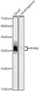Western blot analysis of extracts of various cell lines, using PVRIG antibody (CAB21303) at 1:500 dilution. Secondary antibody: HRP Goat Anti-Rabbit IgG (H+L) at 1:10000 dilution. Lysates/proteins: 25μg per lane. Blocking buffer: 3% nonfat dry milk in TBST.