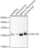 Western blot analysis of extracts of various tissues from Arabidopsis thaliana, using TIFY11B antibody (CAB21305) at 1:500 dilution. Secondary antibody: HRP Goat Anti-Rabbit IgG (H+L) at 1:10000 dilution. Lysates/proteins: 25μg per lane. Blocking buffer: 3% nonfat dry milk in TBST.
