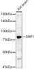 Western blot analysis of extracts of Rat brain, using DRP1 antibody (CAB21310) at 1:400 dilution. Secondary antibody: HRP Goat Anti-Rabbit IgG (H+L) at 1:10000 dilution. Lysates/proteins: 25μg per lane. Blocking buffer: 3% nonfat dry milk in TBST.