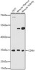 Western blot analysis of extracts of various cell lines, using CDK4 antibody (CAB21317) at 1:1000 dilution. Secondary antibody: HRP Goat Anti-Rabbit IgG (H+L) at 1:10000 dilution. Lysates/proteins: 25μg per lane. Blocking buffer: 3% nonfat dry milk in TBST.