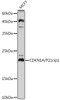 Western blot analysis of extracts of MCF7 cells, using CDKN1A/P21cip1 antibody (CAB21323) at 1:1000 dilution. Secondary antibody: HRP Goat Anti-Rabbit IgG (H+L) at 1:10000 dilution. Lysates/proteins: 25μg per lane. Blocking buffer: 3% nonfat dry milk in TBST.
