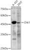 Western blot analysis of various lysates, using Chk1 Rabbit pAb (CAB21348) at 1:500 dilution. Secondary antibody: HRP Goat Anti-Rabbit IgG (H+L) at 1:10000 dilution. Lysates/proteins: 25ug per lane. Blocking buffer:3% nonfat dry milk in TBST.