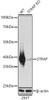 Western blot analysis of extracts from wild type(WT) and STRAP knockout (KO) HeLa cells, using STRAP Rabbit pAb (CAB21351) at 1:1000 dilution. Secondary antibody: HRP Goat Anti-Rabbit IgG (H+L) at 1:10000 dilution. Lysates/proteins: 25μg per lane. Blocking buffer: 3% nonfat dry milk in TBST.