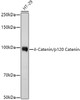 Western blot analysis of extracts of HT-29 cells, using δ-Catenin/p120 Catenin antibody (CAB21371) at 1:1000 dilution. Secondary antibody: HRP Goat Anti-Rabbit IgG (H+L) at 1:10000 dilution. Lysates/proteins: 25μg per lane. Blocking buffer: 3% nonfat dry milk in TBST.