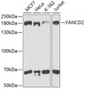 Western blot analysis of extracts of various cell lines, using FANCD2 antibody (CAB21397) at 1:1000 dilution. Secondary antibody: HRP Goat Anti-Rabbit IgG (H+L) at 1:10000 dilution. Lysates/proteins: 25μg per lane. Blocking buffer: 3% nonfat dry milk in TBST.
