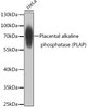 Western blot analysis of extracts of HeLa cells, using Placental alkaline phosphatase (PLAP) antibody (CAB21424) at 1:1000 dilution. Secondary antibody: HRP Goat Anti-Rabbit IgG (H+L) at 1:10000 dilution. Lysates/proteins: 25μg per lane. Blocking buffer: 3% nonfat dry milk in TBST.