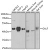 Western blot analysis of extracts of various cell lines, using GALT Rabbit pAb (CAB21426) at 1:1000 dilution. Secondary antibody: HRP Goat Anti-Rabbit IgG (H+L) at 1:10000 dilution. Lysates/proteins: 25μg per lane. Blocking buffer: 3% nonfat dry milk in TBST.
